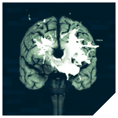 Icon for Brain Surgery